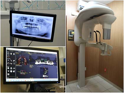 CAD CAM - Algodones Dental Center