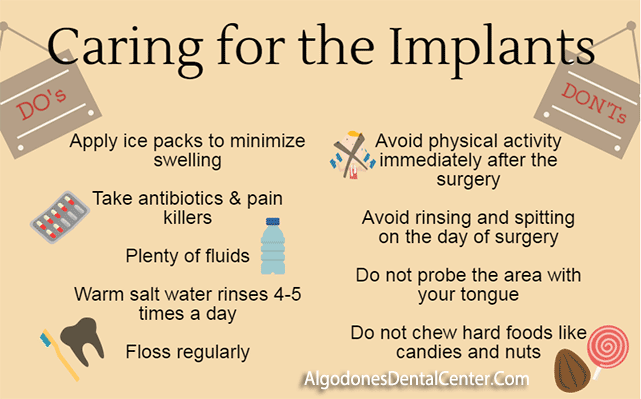 Taking Care of Dental Implants - Infographic