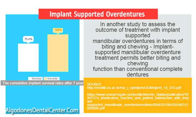 Implant Overdentures vs. Traditional Dentures